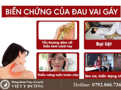 bien-chung-dau-vai-gay