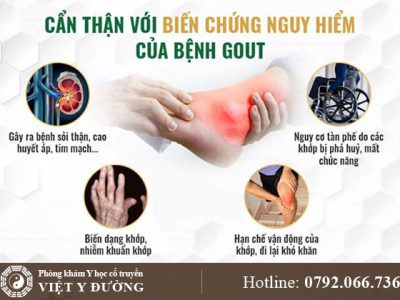 bien-chung-gout