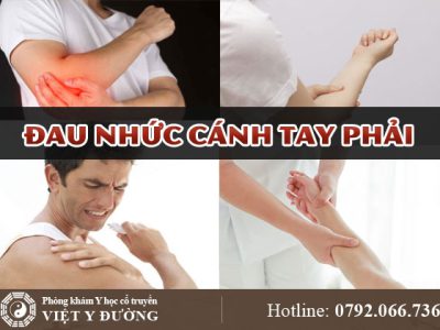 dau-nhuc-canh-tay-phai