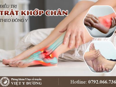 dieu-tri-trat-khop-chan