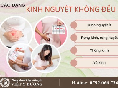 kinh-nguyet-khong-deu-0