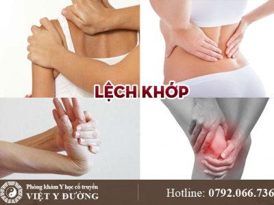 lech-khop