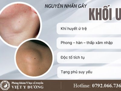 nguyen-nhan-khoi-u