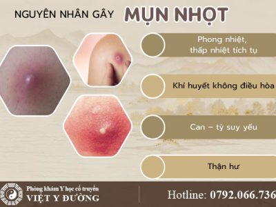 nguyen-nhan-mun-nhot