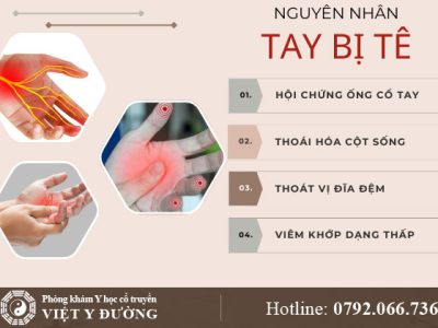 nguyen-nhan-tay-bi-te