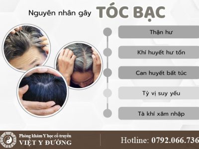 nguyen-nhan-toc-bac