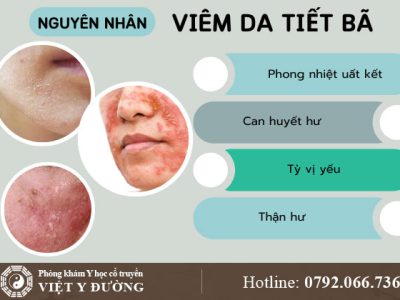 nguyen-nhan-viem-da-tiet-ba