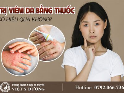 tri-viem-da-bang-thuoc