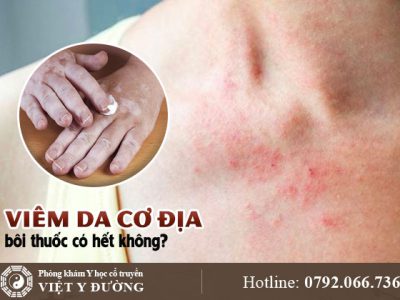 viem-da-co-dia-boi-thuoc
