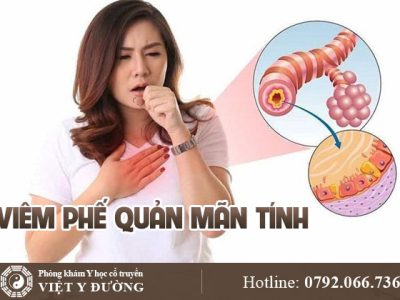 viem-phe-quan-man-tinh